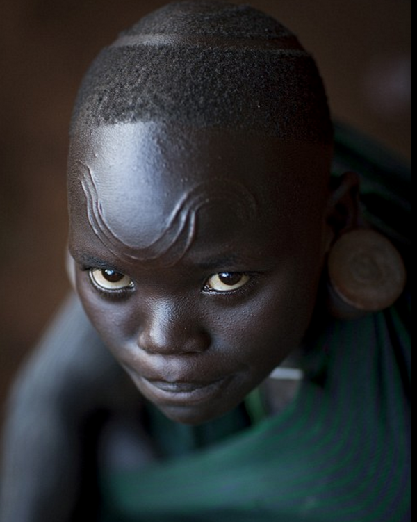 Surma girl from Ethiopia. The Suri pride themselves on their scars and how many they carry. Women perform scarification by slicing their skin with a razor blade after lifting it with a thorn. After the skin is sliced the piece of skin left over is left to eventually scar. 