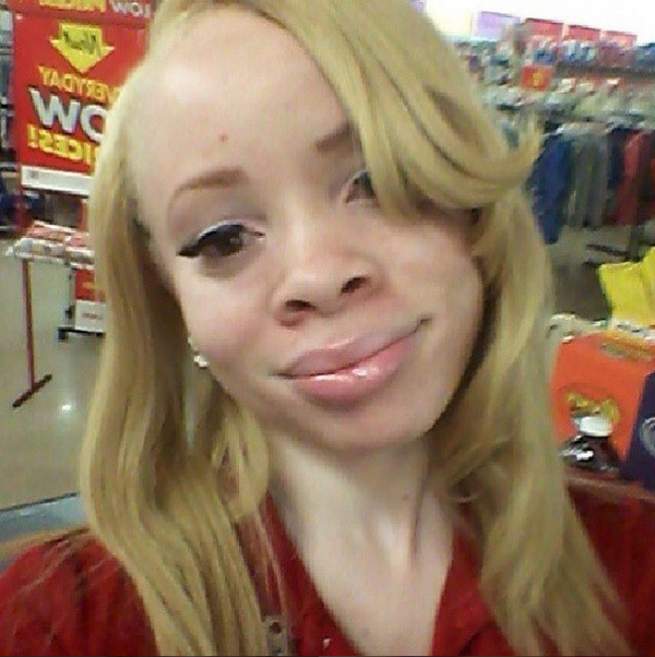 Instagram.com/https://instagram.com/sirmaejor/  Meet my friend Starr, she's a beautiful woman with albinism